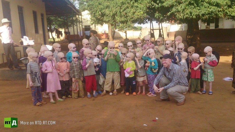 What is albinism?