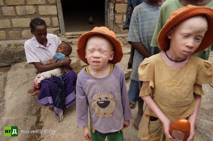 Hunting African albino children