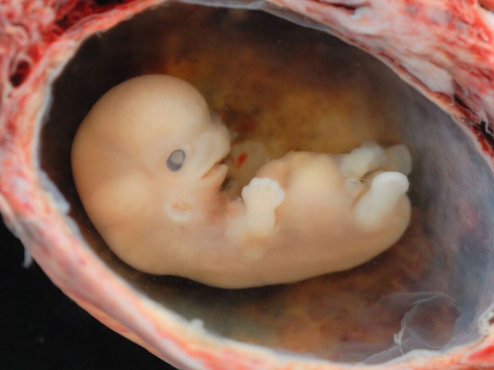 human 8 week old embryo