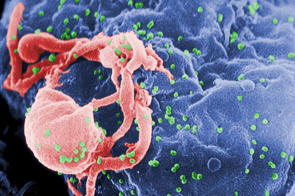 Microscopic photo of HIV viruses (in green) budding from cultured lymphocyte