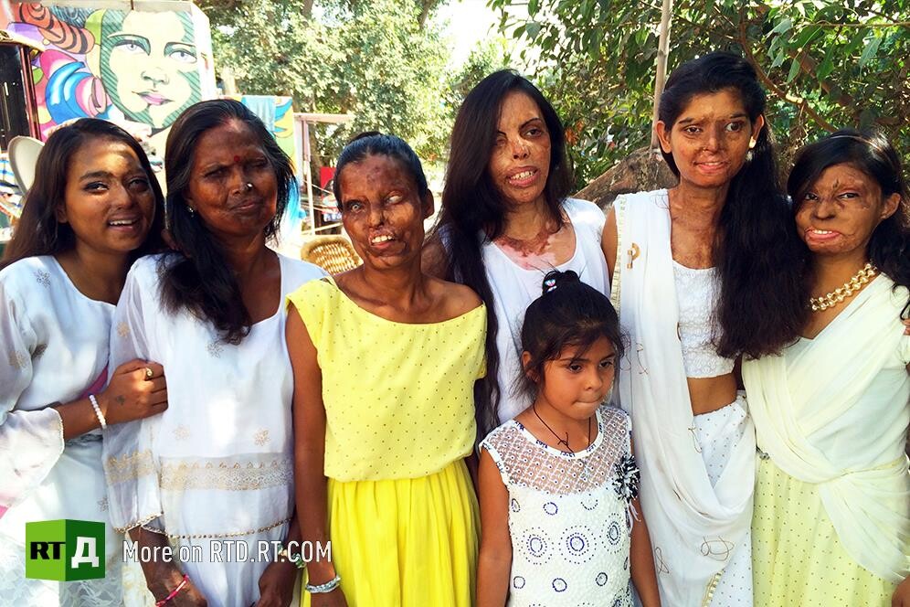 India acid attack victims